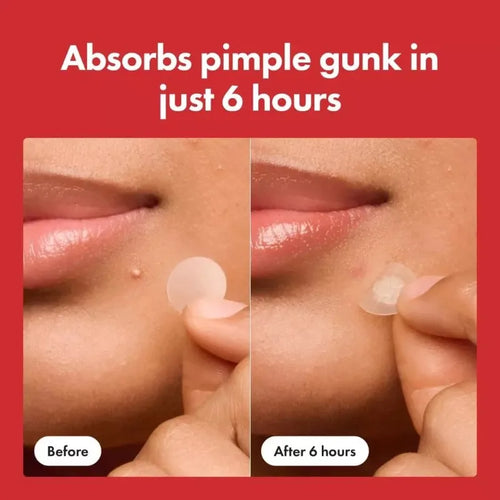 ClearSkin Rapid Fast Pimple Patch